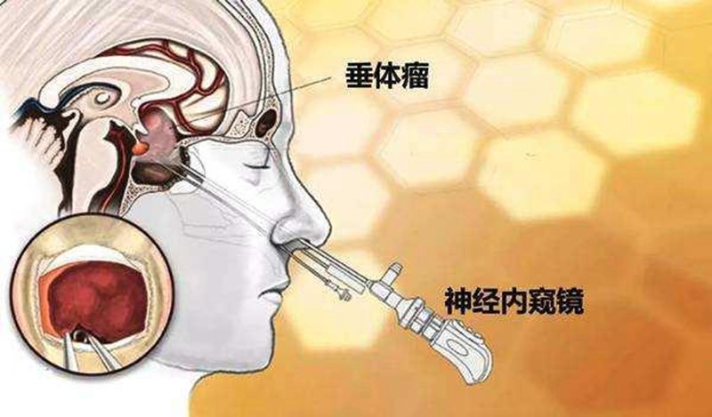 039de3b203b5489f8c7a0926c78bf05c_副本.jpg